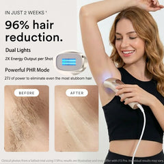 Trinity I15 Pro Sapphire Ice Cooling 27J Laser Hair Removal Device IPL Laser 999999 0.15S/Flash 2 Light 4 Pulse Home Epilator